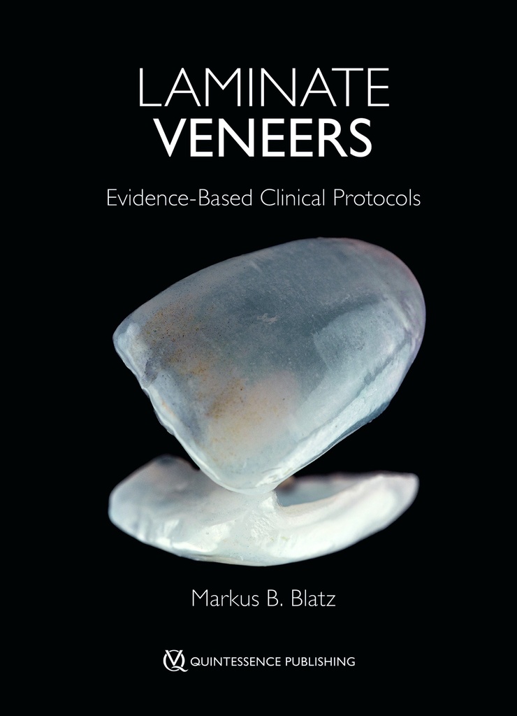 Laminate Veneers Evidence-Based Clinical Protocols