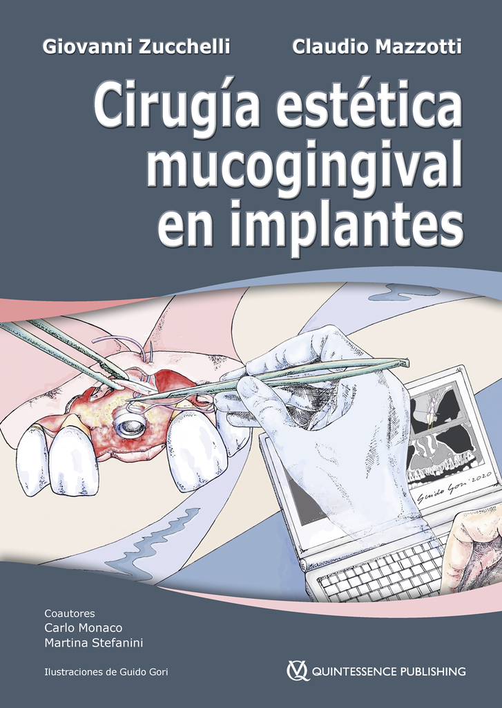 CIRUGÍA ESTÉTICA MUCOGINGIVAL EN IMPLANTES