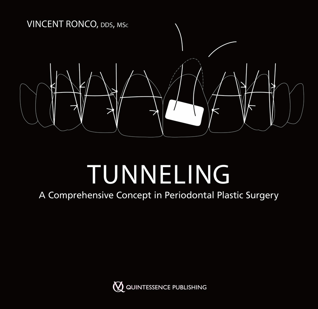 TUNNELING, A COMPREHENSIVE CONCEPT PERIODONTAL PLASTI