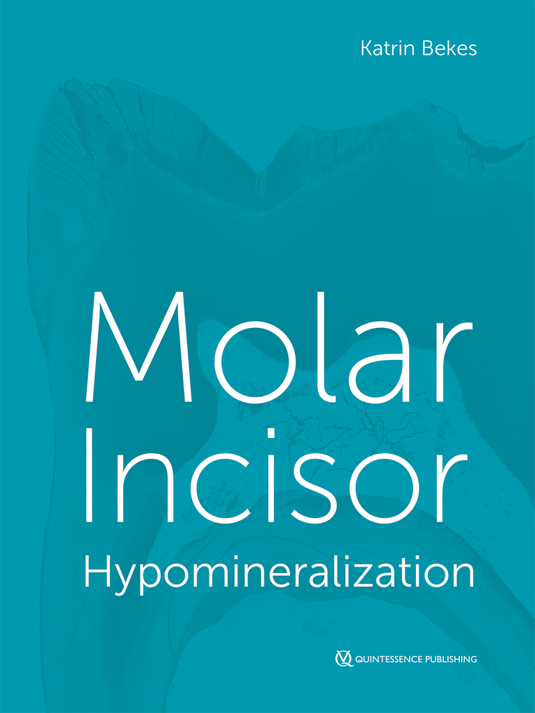 MOLAR INCISOR HYPOMINERALIZATION