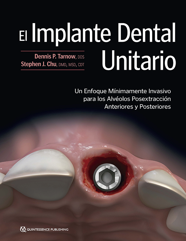 EL IMPLANTE UNITARIO (DIGITAL)