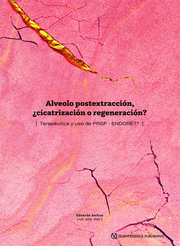 ALVEOLO POSTEXTRACCION,¿CICATRIZACION O REGENERACION?