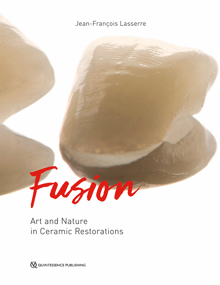 FUSION