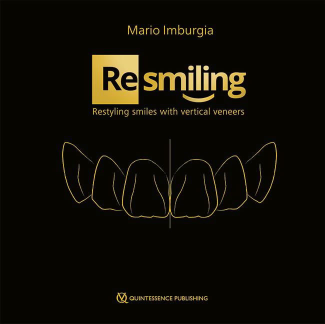 (Re)smiling: Restyling smiles with vertical veneers
