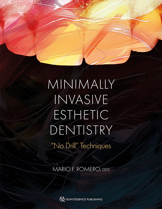 Minimally Invasive Esthetic Dentistry: "No Drill" Techniques