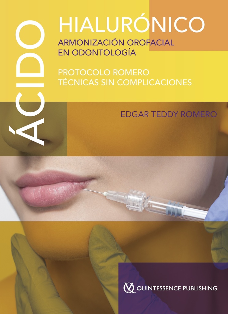 ÁCIDO HIALURÓNICO. ARMONIZACIÓN OROFACIAL EN ODONTOLOGÍA