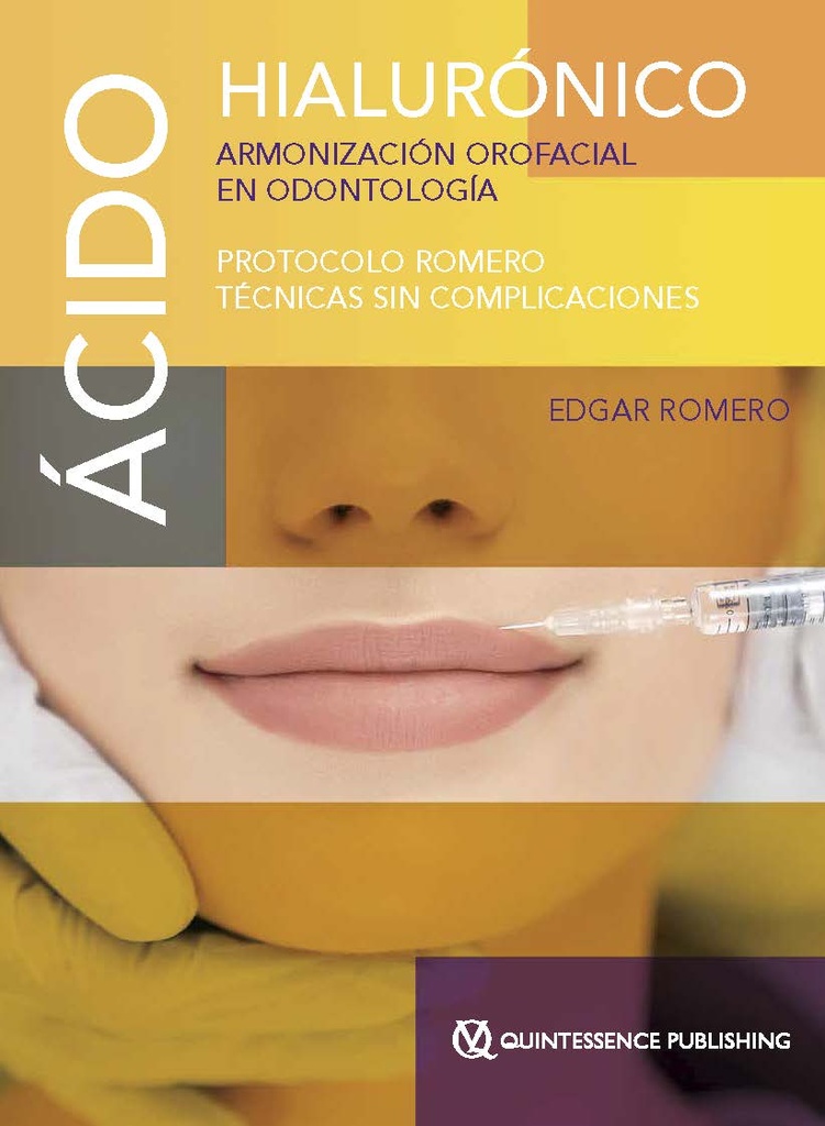 ÁCIDO HIALURÓNICO. ARMONIZACIÓN OROFACIAL EN ODONTOLOGÍA