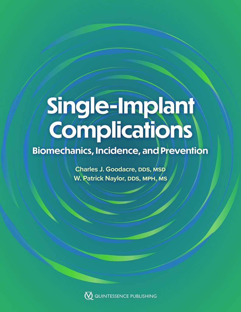 Single-Implant Complications Biomechanics, Incidence, and Prevention