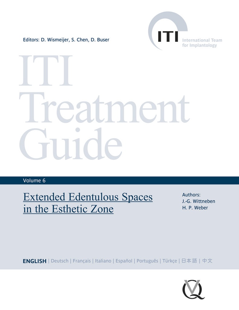 ITI TREATMENT GUIDE - VOLUME 6—EXTENDED EDENTULOUS SPACES IN THE ESTHETIC ZONE