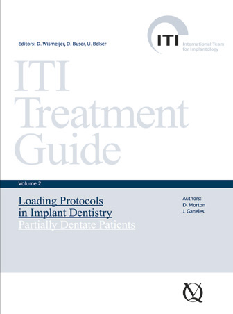 ITI TREATMENT GUIDE - VOLUME 2—LOADING PROTOCOLS IN IMPLANT DENTISTRY: PARTIALLY DENTATE PATIENTS