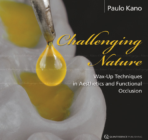 CHALLENGING NATURE: WAX-UP TECHNIQUE IN AESTHETICS AND FUNCTIONAL OCCLUSION