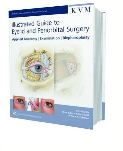 ILLUSTRATED GUIDE TO EYELID AND PERIORBITAL SURGERY 