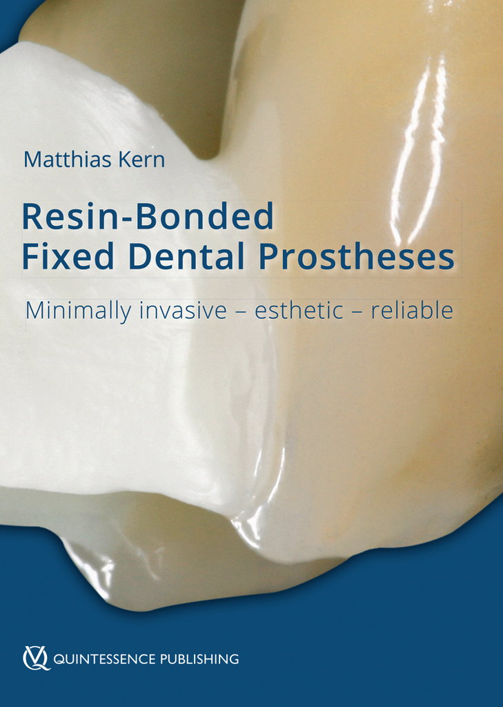 RBFDPS - RESIN-BONDED FIXED DENTAL PROSTHESES MINIMALLY INVASIVE - ESTHETIC - RELIABLE