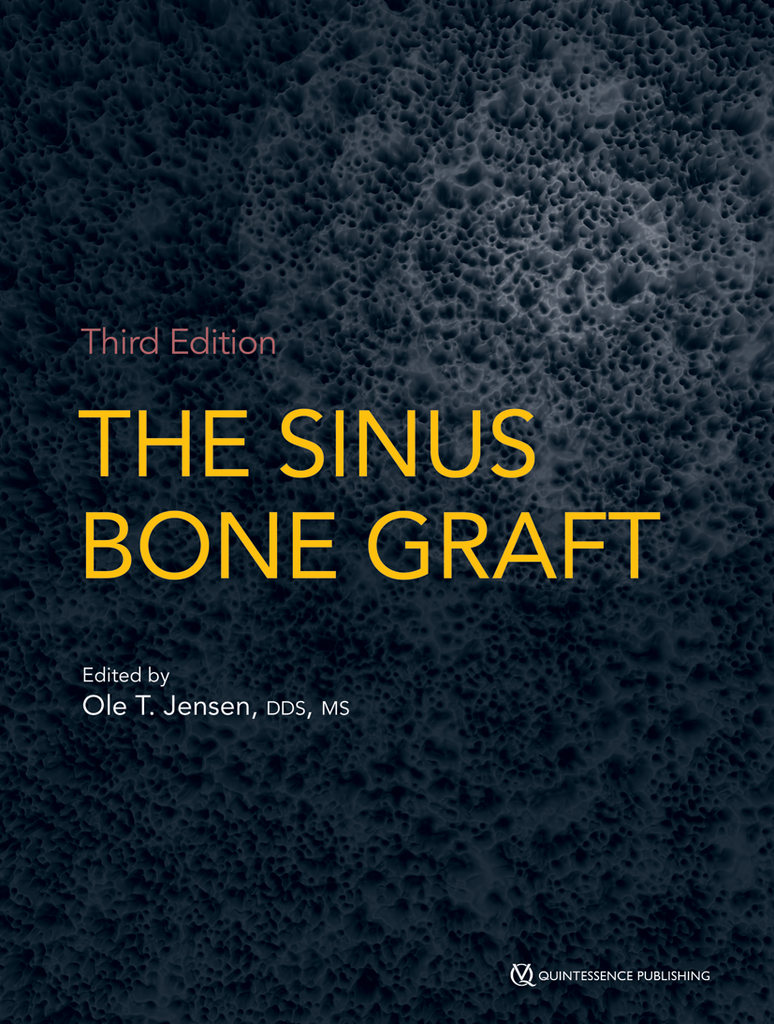 THE SINUS BONE GRAFT