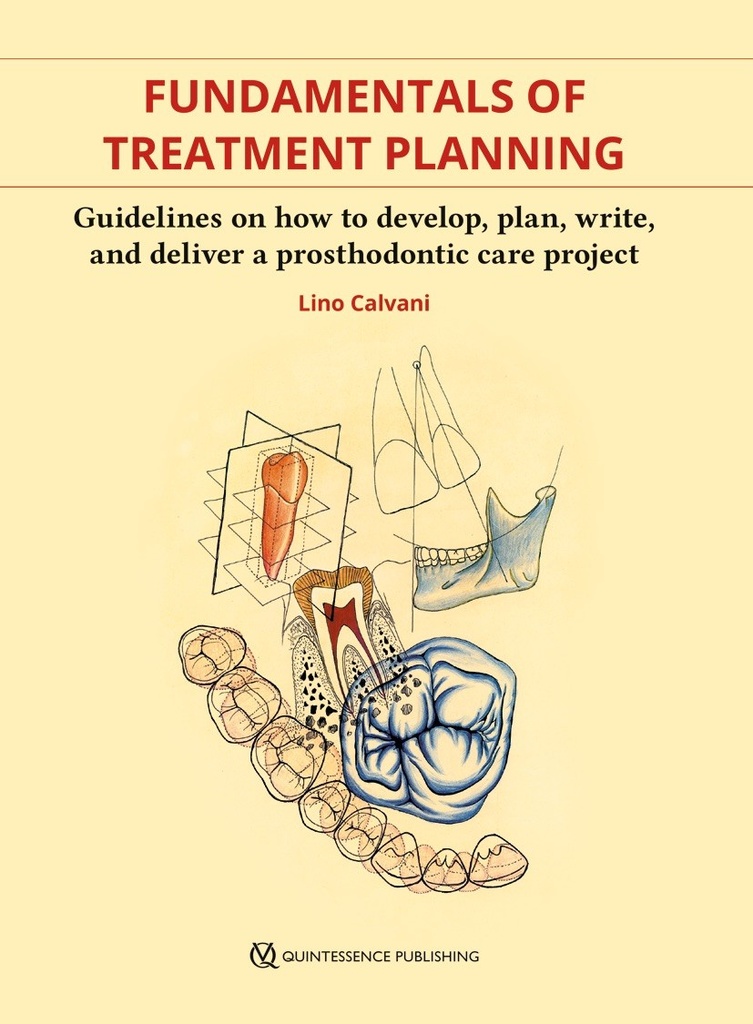FUNDAMENTALS OF TREATMENT PLANNING GUIDELINES ON HOW TO DEVELOP, PLAN, WRITE, AND DELIVER A PROSTHODONTIC CARE PROJECT