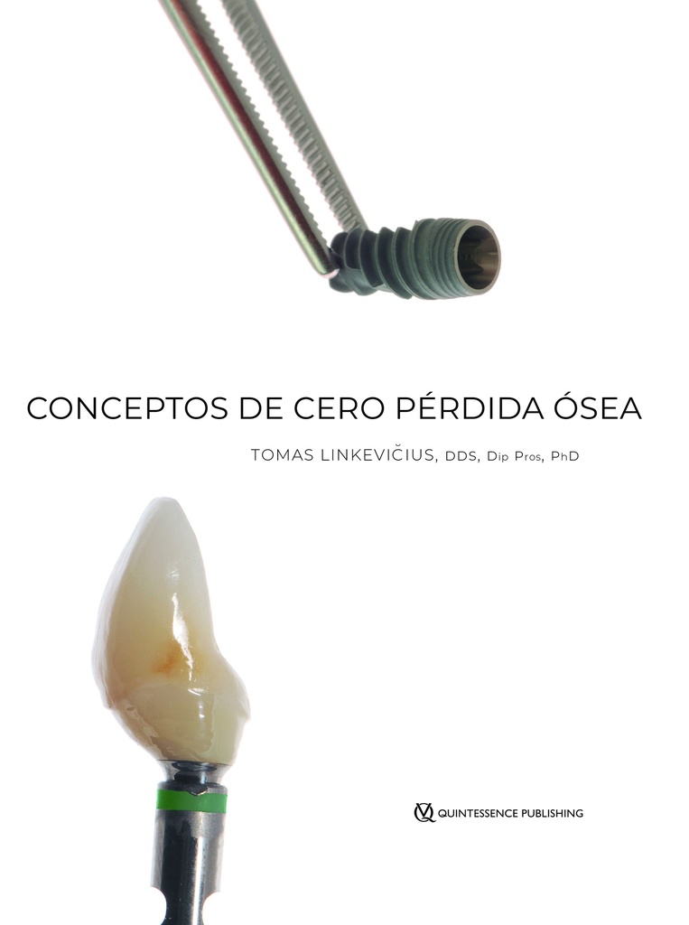 CONCEPTOS DE CERO PÉRDIDA ÓSEA