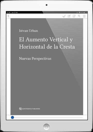 URBAN,EL AUMENTO VERTICAL Y HORIZONTAL DE LA CRESTA(DIGITAL)