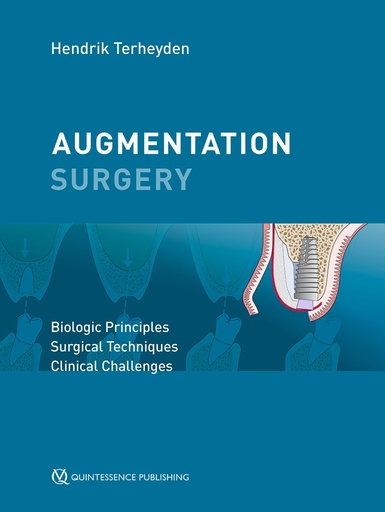 [978-1-78698-113-4] AUGMENTATION SURGERY