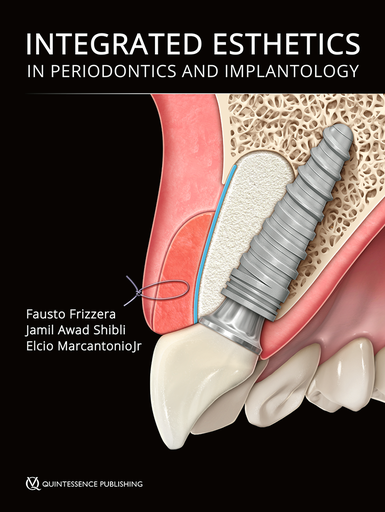 [978-1-78698-098-4] INTEGRATED ESTHETICS IN PERIODONTICS AND IMPLANTOLOGY