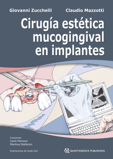[978-84-89873-94-0] CIRUGÍA ESTÉTICA MUCOGINGIVAL EN IMPLANTES