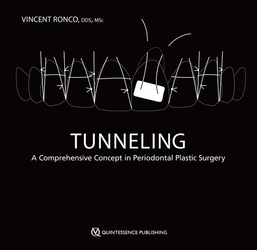 [978-1-64724-138-4] TUNNELING, A COMPREHENSIVE CONCEPT PERIODONTAL PLASTI