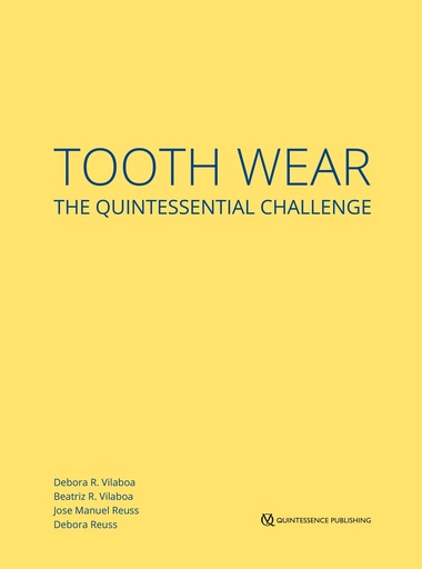 [978-1-78698-120-2] TOOTH WEAR THE QUINTESSENTIAL CHALLENGE