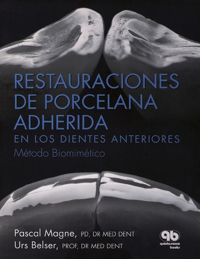RESTAURACIONES DE PORCELANA ADHERIDA(DIGITAL)