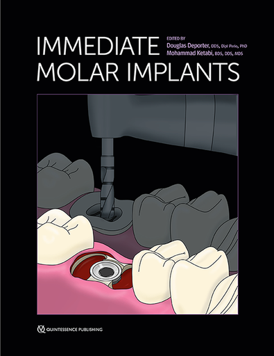 [978-0-86715-954-7] IMMEDIATE MOLAR IMPLANTS