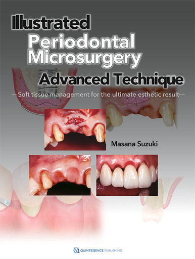 [978-4-7812-0906-7] ILLUSTRATED ADVANCED TECHNIQUE OF PERIODONTAL MICROSURGERY