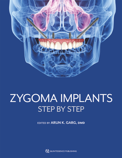 [978-1-64724-157-5] ZYGOMA IMPLANTS
