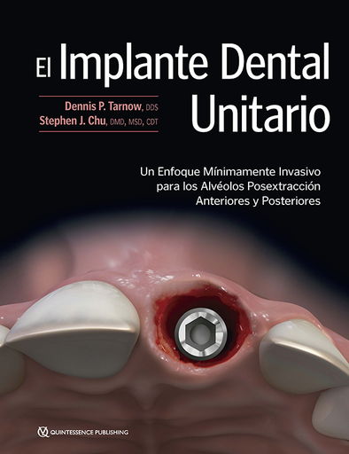 EL IMPLANTE UNITARIO (DIGITAL)