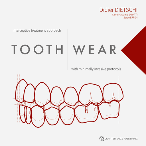 [978-1-78698-115-8] TOOTH WEAR WITH MINIMALLY INVASIVE PROTOCOLS