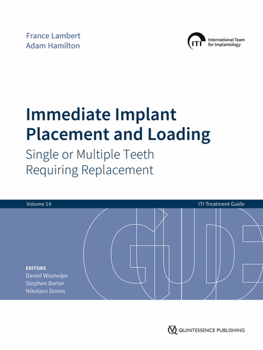 [978-1-78698-127-1] ITII TREATMENT GUIDE - VOLUME 14 - IMMEDIATE IMPLANT PLACEMENT AND LOADING