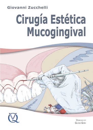 CIRUGIA ESTETICA MUCOGINGIVAL (DIGITAL)