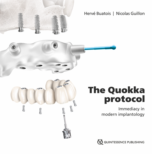[978-2-36615-078-0] THE QUOKKA PROTOCOL IMMEDIACY IN MODERN IMPLANTOLOGY