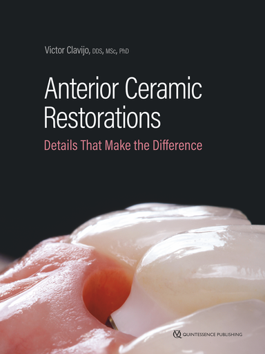 [978-1-78698-135-6] ANTERIOR CERAMIC RESTORATIONS