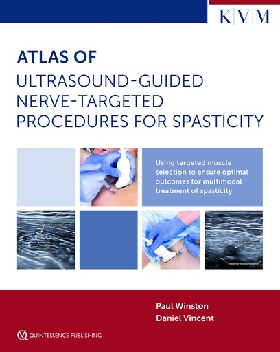 [978-1-78698-128-8] Atlas of Ultrasound-Guided Nerve-Targeted Procedures for Spasticity