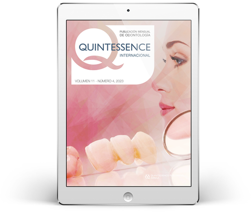 [2014-9026] Quintessence Internacional (digital)