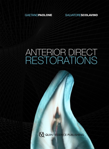 [978-88-7492-200-0] ANTERIOR DIRECT RESTORATIONS