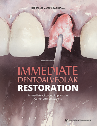 [978-1-64724-171-1] IMMEDIATE DENTOALVEOLAR RESTORATION. Immediately Loaded Implants in Compromised Sockets