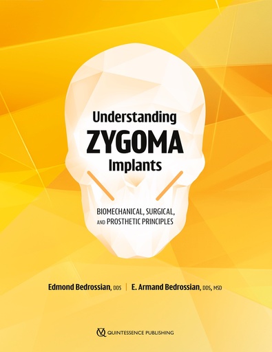 [978-1-64724-195-7] Understanding Zygoma Implants Biomechanical, Surgical, and Prosthetic Principles