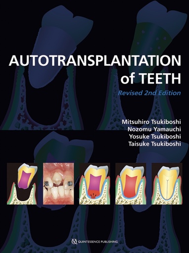 [978-4-7812-1008-7] Autotransplantation of Teeth