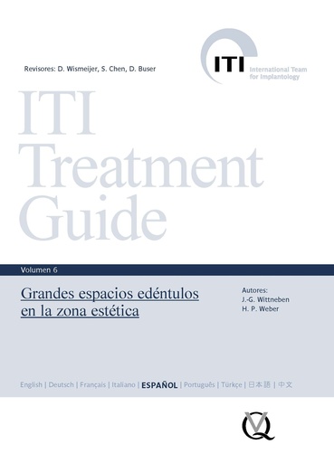 [978-84-89873-56-8] ITI Vol. 6 - Grandes Espacios Edéntulos en la Zona Estética