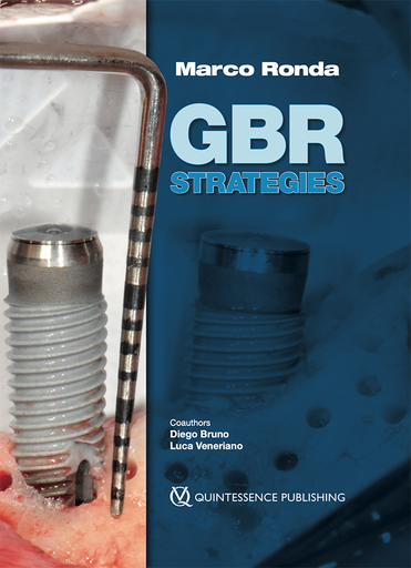 [978-88-7492-205-5] GBR Strategies
