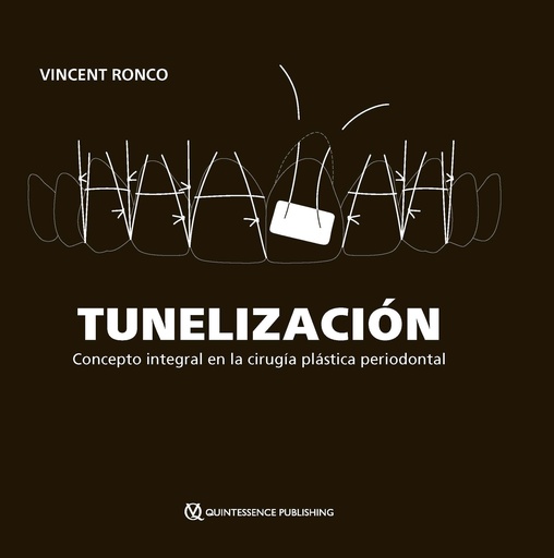 [978-84-128982-5-5] TUNELIZACIÓN. Concepto integral en la cirugía plástica periodontal