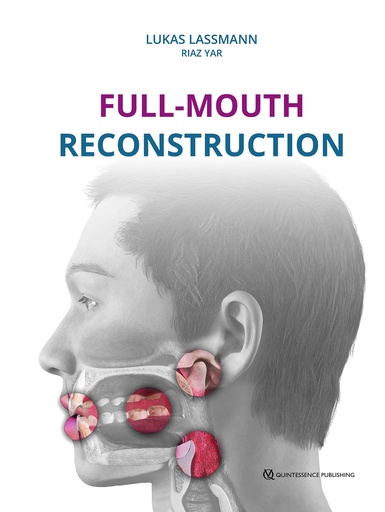 [978-1-78698-153-0] Full-Mouth Reconstruction