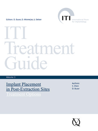 [978-3-938947-14-2] ITI TREATMENT GUIDE - VOLUME 3—IMPLANT PLACEMENT IN POST-EXTRACTION SITES: TREATMENT OPTIONS