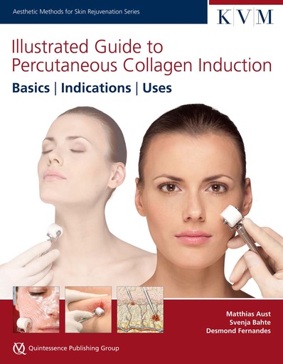 [978-1-85097-253-2] ILLUSTRATED GUIDE TO PERCUTANEOUS COLLAGEN INDUCTION