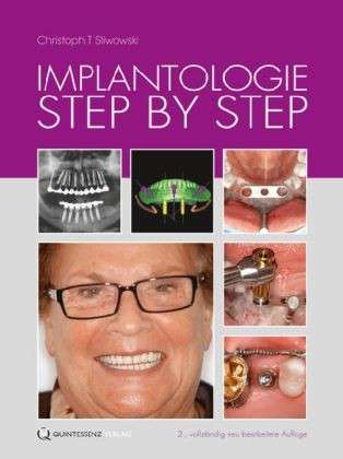 IMPLANTOLOGY STEP BY STEP