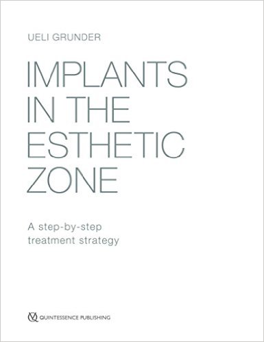 [978-1-85097-283-9] IMPLANTS IN THE ESTHETIC ZONE: A STEP-BY-STEP TREATMENT STRATEGY